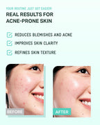 BRING GREEN Tea Tree Cica Soothing Cream for Sensitive/Acne-Prone Skin (100ml)