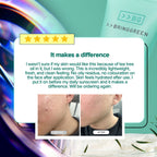 BRING GREEN Tea Tree Cica Soothing Cream for Sensitive/Acne-Prone Skin (100ml)